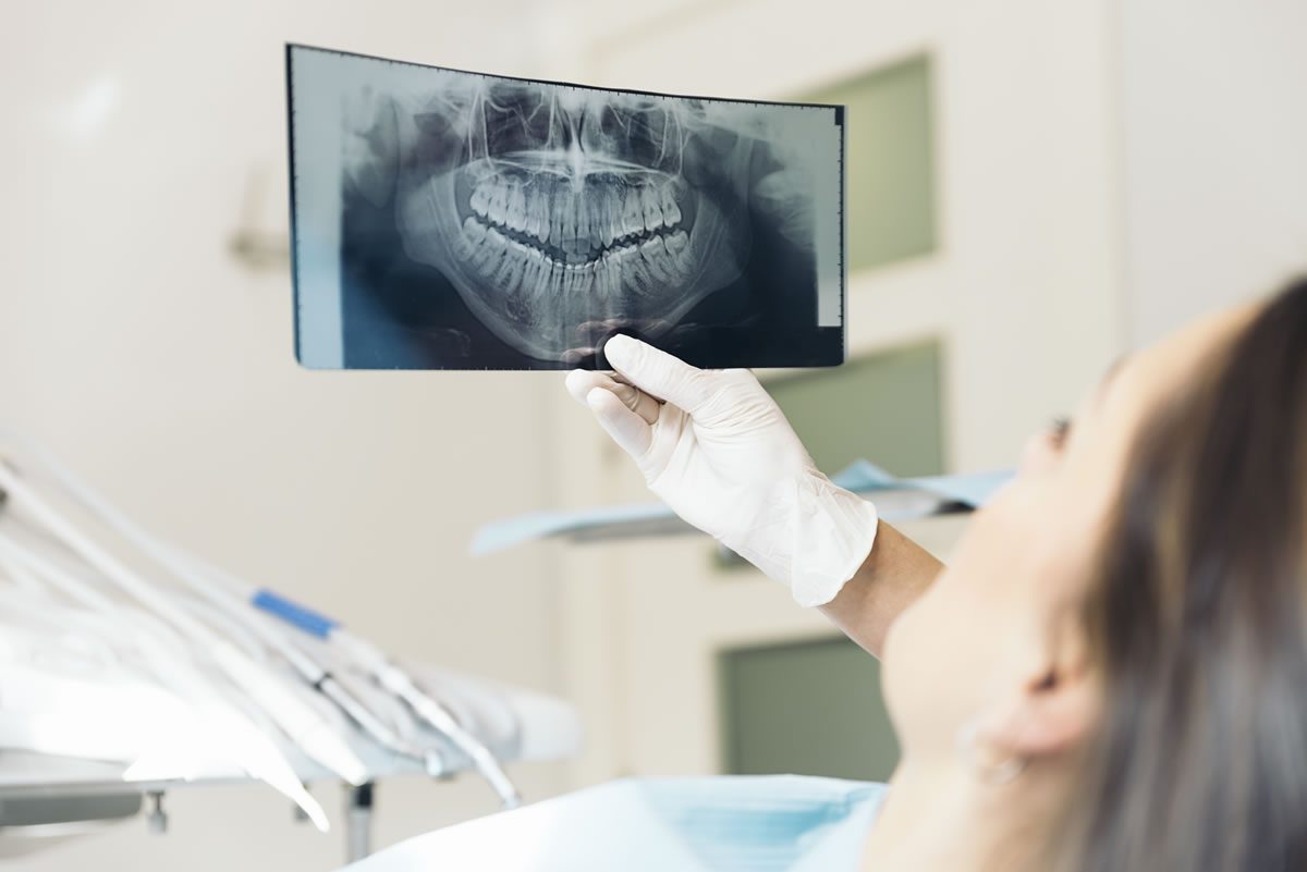 Dental professional examining panoramic X-ray of patient's teeth and jaw at our dental clinic