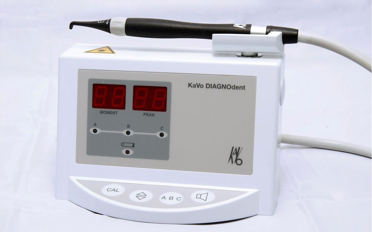KaVo DIAGNOdent laser fluorescence device for detecting dental caries at our dental clinic